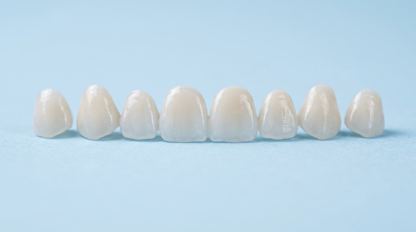 Veneers